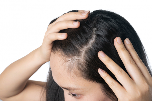 Flawless Solutions for Common Hair Woes